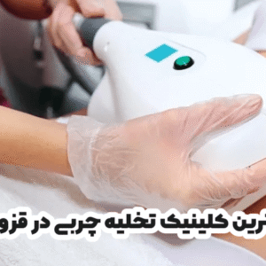 بهترین کلینیک تخلیه چربی در قزوین