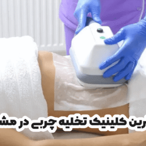 بهترین کلینیک تخلیه چربی در مشهد