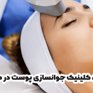 بهترین کلینیک جوانسازی پوست در همدان