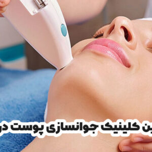 بهترین کلینیک جوانسازی پوست در زابل