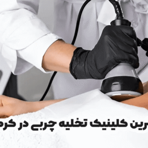 بهترین کلینیک تخلیه چربی در کرمان