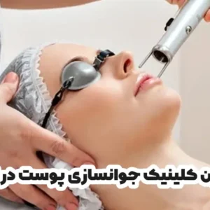 بهترین کلینیک جوانسازی پوست در ایلام