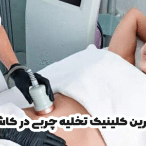 بهترین کلینیک تخلیه چربی در کاشان