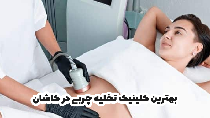 بهترین کلینیک تخلیه چربی در کاشان