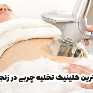 بهترین کلینیک تخلیه چربی در زنجان