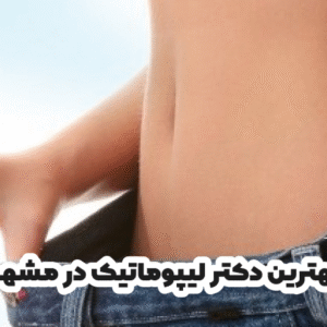 بهترین دکتر لیپوماتیک در مشهد