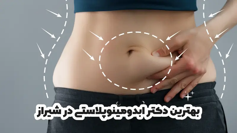 بهترین دکتر ابدومینوپلاستی در شیراز