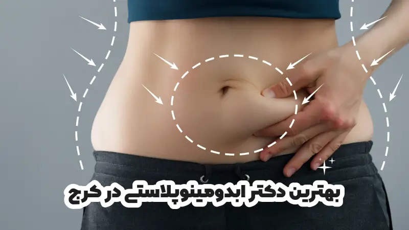 بهترین دکتر ابدومینوپلاستی در کرج