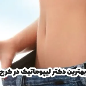 بهترین دکتر لیپوماتیک در کرج