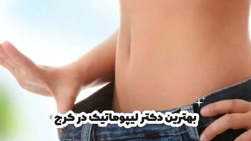 بهترین دکتر لیپوماتیک در کرج