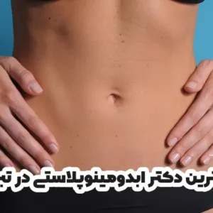 بهترین دکتر ابدومینوپلاستی در تبریز
