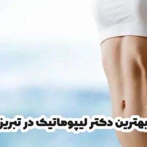 بهترین دکتر لیپوماتیک در تبریز