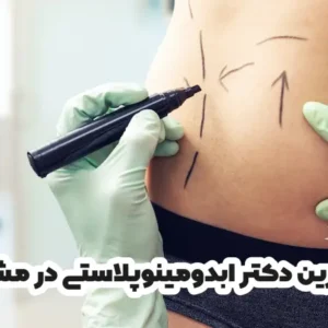 بهترین دکتر ابدومینوپلاستی در مشهد