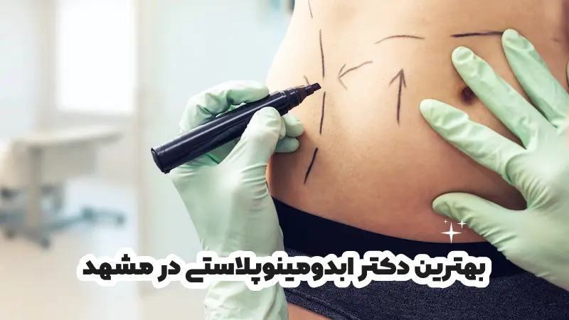 بهترین دکتر ابدومینوپلاستی در مشهد