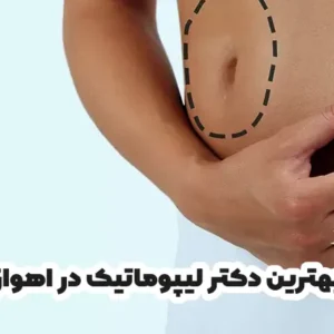 بهترین دکتر لیپوماتیک در اهواز