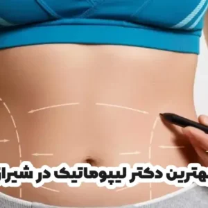 بهترین دکتر لیپوماتیک در شیراز