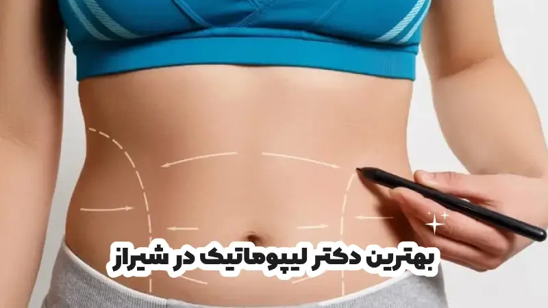 بهترین دکتر لیپوماتیک در شیراز
