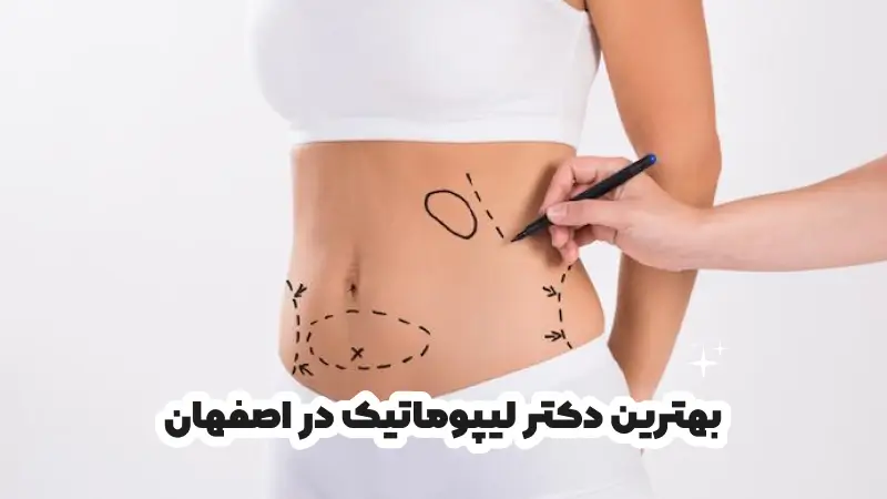 بهترین دکتر لیپوماتیک در اصفهان
