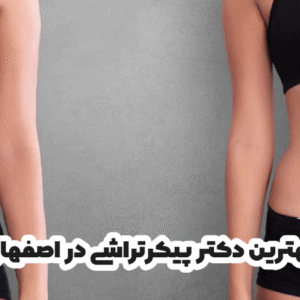 بهترین دکتر پیکرتراشی در اصفهان