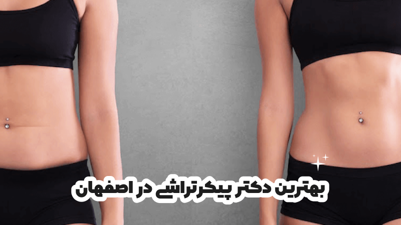 بهترین دکتر پیکرتراشی در اصفهان