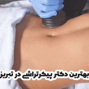 بهترین دکتر پیکرتراشی در تبریز