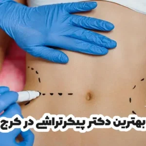 بهترین دکتر پیکرتراشی در کرج