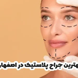 بهترین جراح پلاستیک در اصفهان