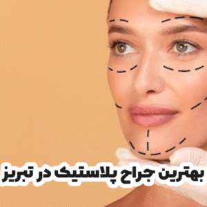 بهترین جراح پلاستیک در تبریز