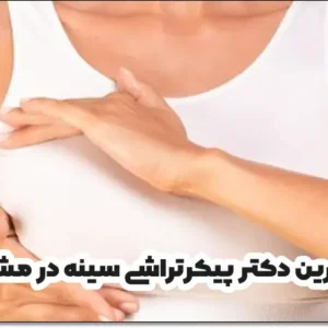 بهترین دکتر پیکرتراشی سینه در مشهد
