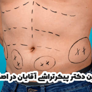بهترین دکتر پیکرتراشی آقایان در اصفهان