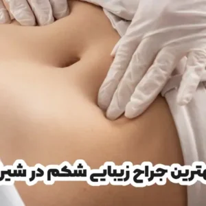 بهترین جراح زیبایی شکم در شیراز