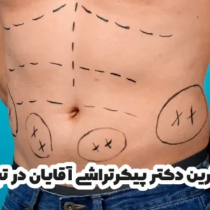 بهترین دکتر پیکرتراشی آقایان در تبریز