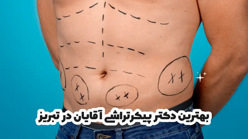 بهترین دکتر پیکرتراشی آقایان در تبریز