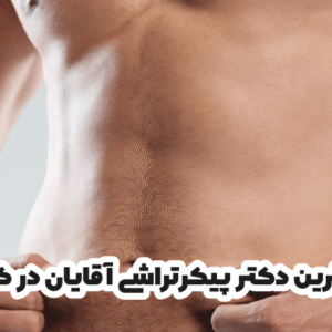 بهترین دکتر پیکرتراشی آقایان در کرج