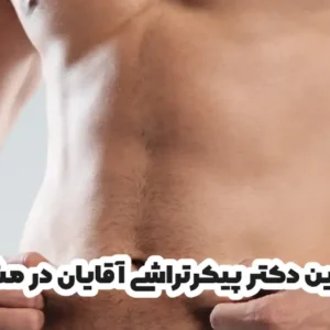 بهترین دکتر پیکرتراشی آقایان در مشهد