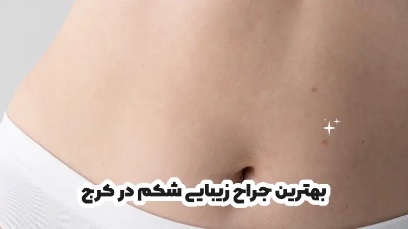 بهترین جراح زیبایی شکم در کرج