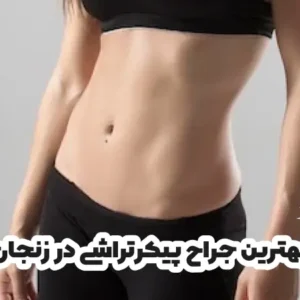 بهترین جراح پیکرتراشی در زنجان