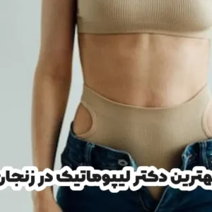 بهترین دکتر لیپوماتیک در زنجان