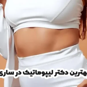بهترین دکتر لیپوماتیک در ساری