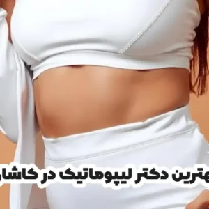 بهترین دکتر لیپوماتیک در کاشان