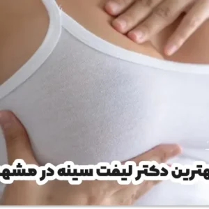 بهترین دکتر لیفت سینه در مشهد