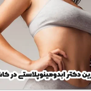 بهترین دکتر ابدومینوپلاستی در کاشان