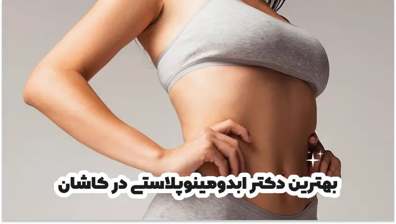 بهترین دکتر ابدومینوپلاستی در کاشان