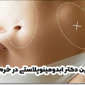 بهترین دکتر ابدومینوپلاستی در خرم آباد