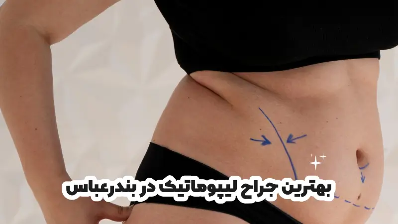 بهترین جراح لیپوماتیک در بندرعباس