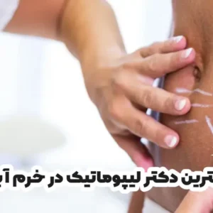 بهترین دکتر لیپوماتیک در خرم آباد