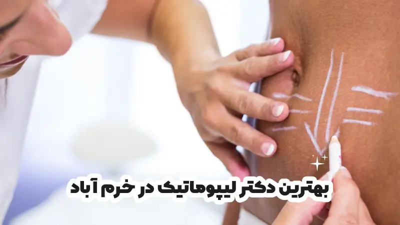 بهترین دکتر لیپوماتیک در خرم آباد