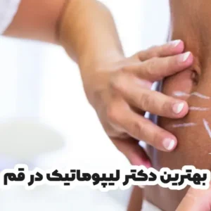 بهترین دکتر لیپوماتیک در قم