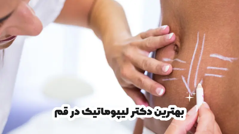 بهترین دکتر لیپوماتیک در قم