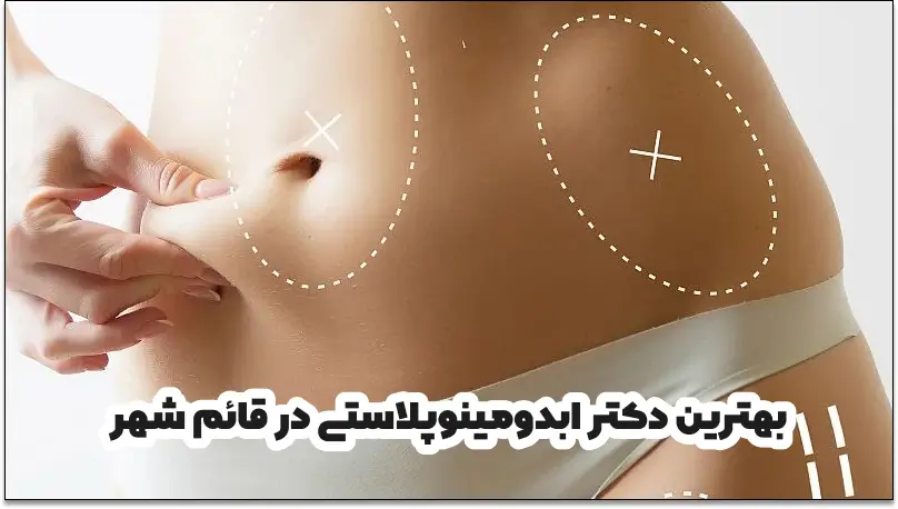 بهترین دکتر لیپوماتیک در قائم شهر